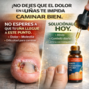 DOBLE RESCATE UNGUEAL™ 👉 LLEVA 2 · PAGA 1 · ENVÍO GRATIS · PAGA AL RECIBIR