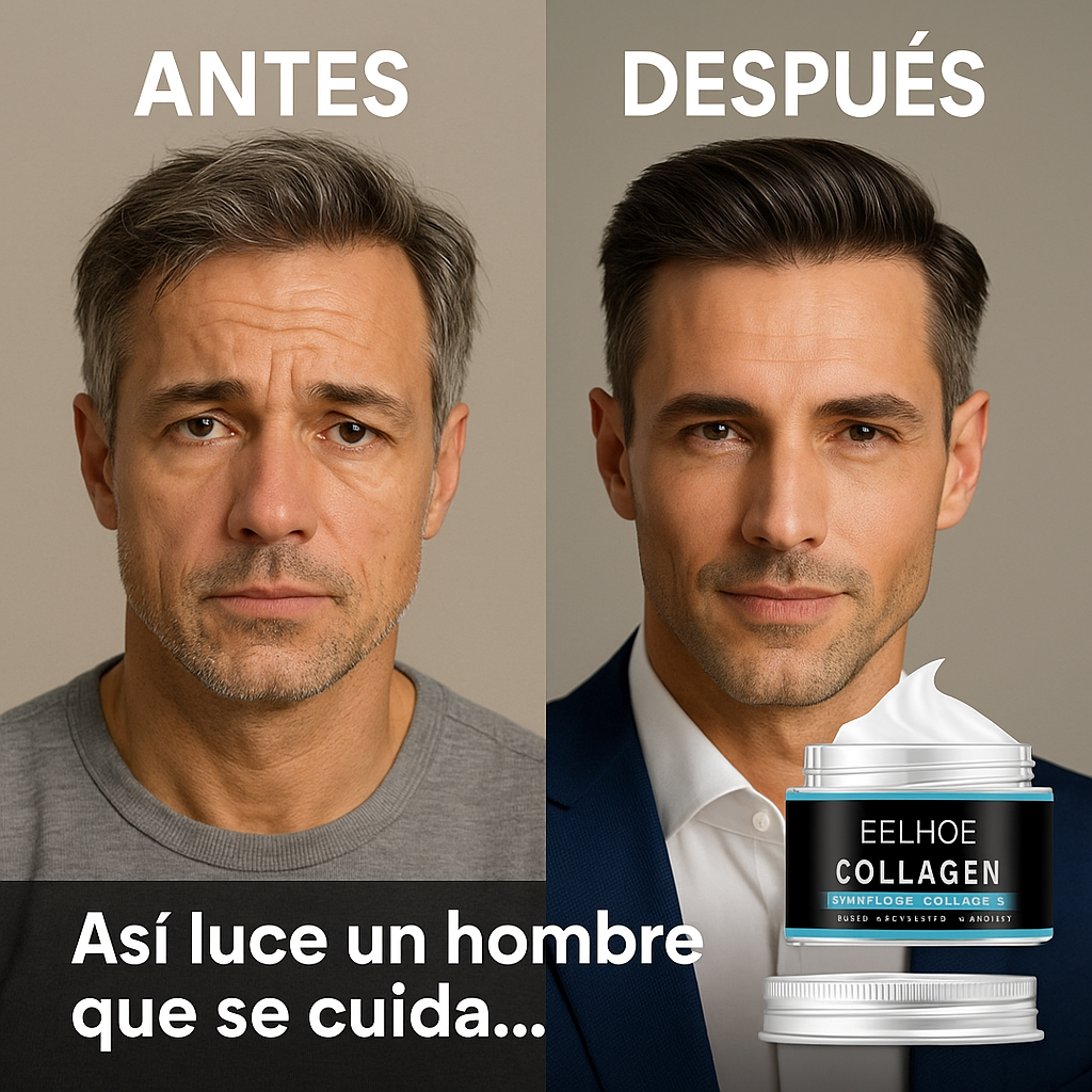 EELHOE – Crema Antiedad Masculina: ¡Compra 1 y recibe 2 + 2 Regalos Especiales!