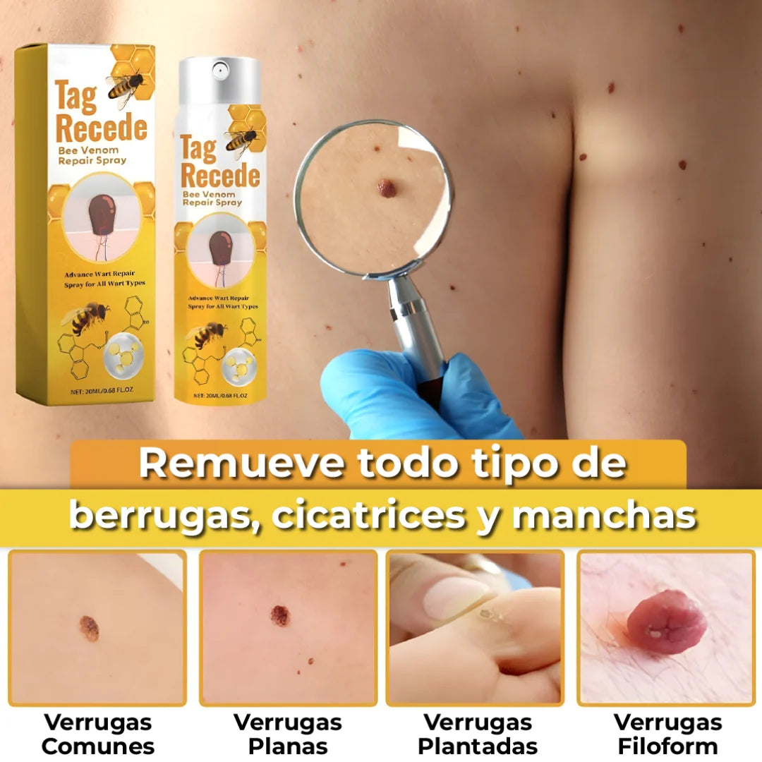 TRATAMIENTO PARA VERRUGAS Y LUNARES🐝👨‍⚕